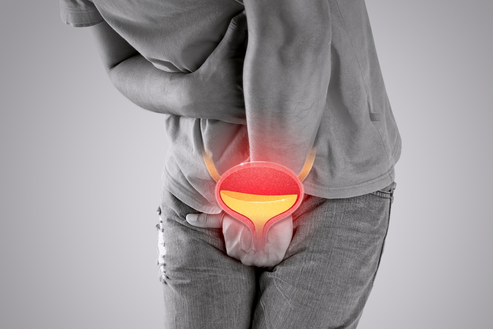 Bladder Cancer Signs, Diagnosis, and Treatment: What San Antonio Patients Need to Know