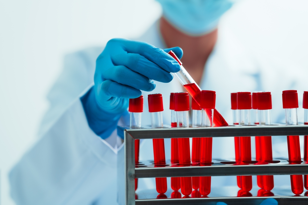 Understanding Hematology: When to See a Blood Disorder Specialist in San Antonio