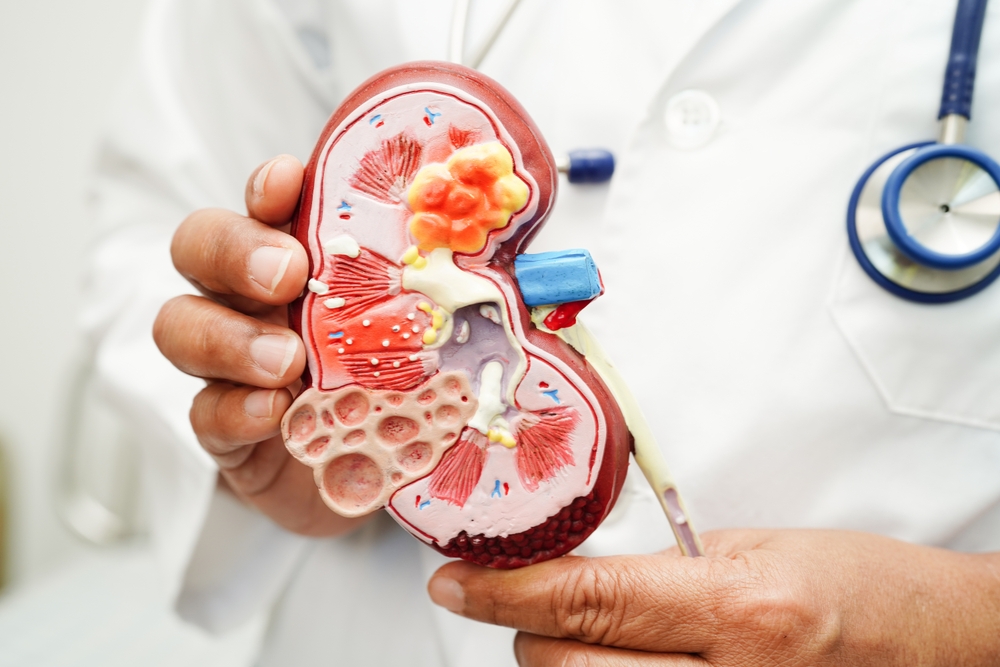 Chronic,kidney,disease,,doctor,with,model,for,treatment,urinary,system,